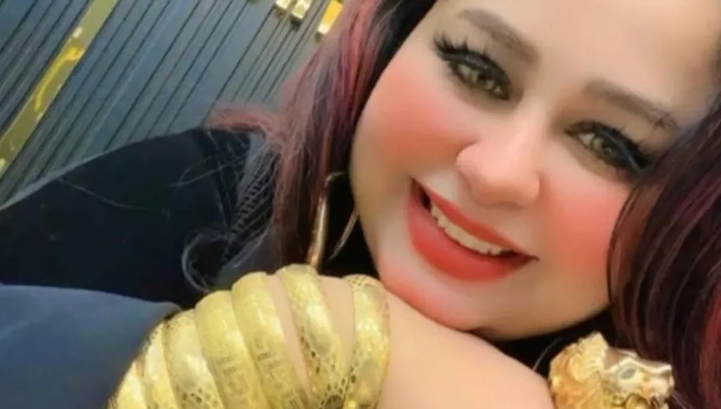 القبض على سيدة انتحلت صفة طبيبة وجمعت ثروة من التجميل المزيّف