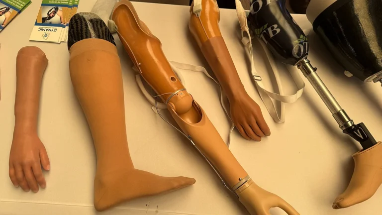 UAE Launches Step Of Hope To Fit 30-40 Prosthetic Limbs For Palestinians In Gaza